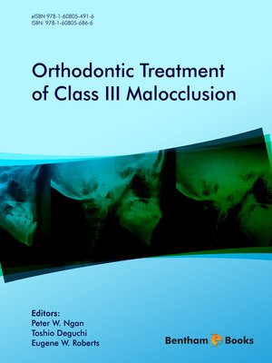 cover image of Orthodontic Treatment of Class III Malocclusion